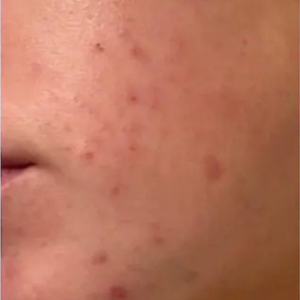 Customer photo, Day 1