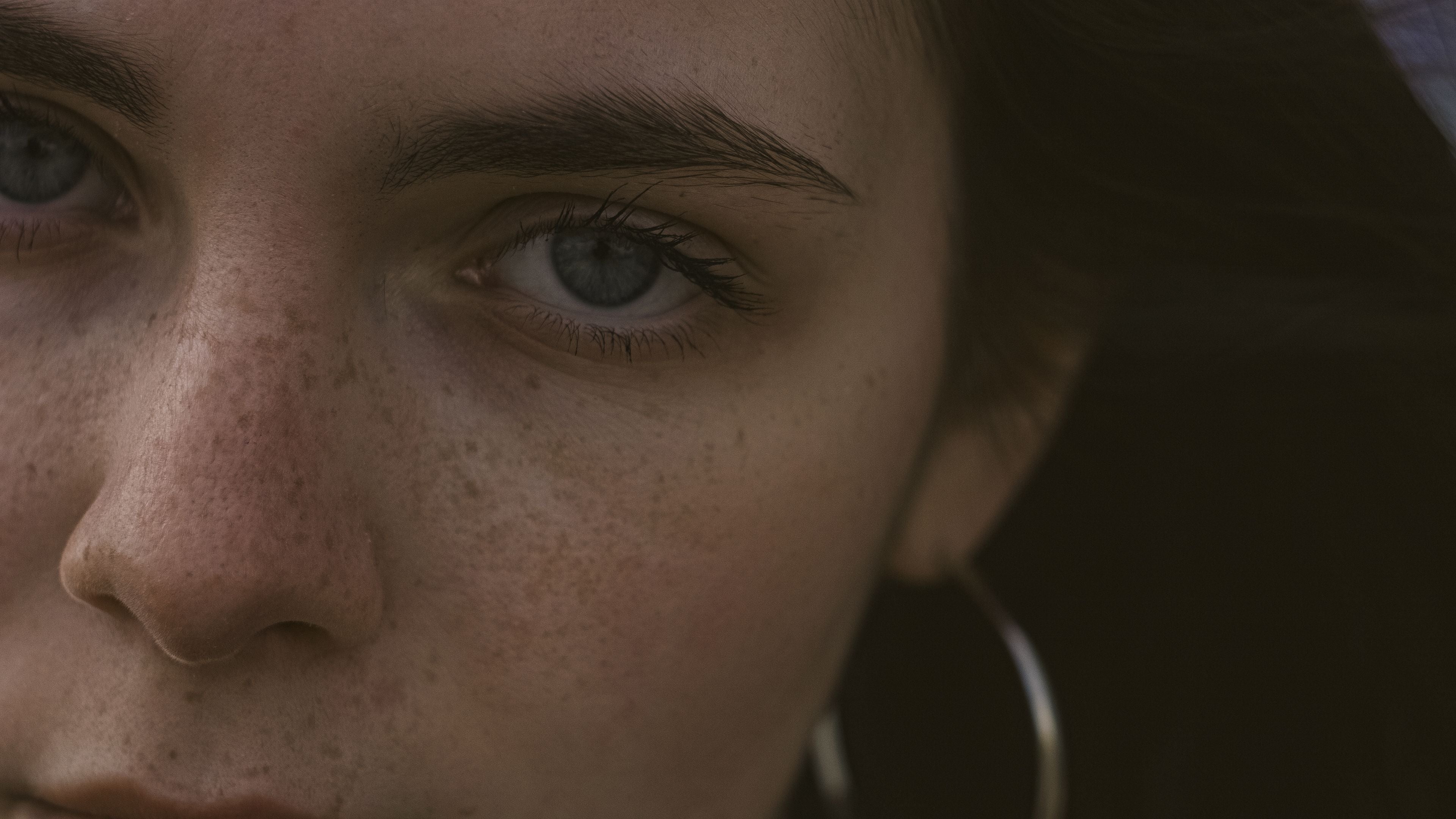 Dark Spots
