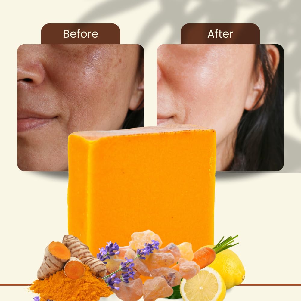 Turmeric Cleansing Soap Bar Brightening Skin 4.5oz