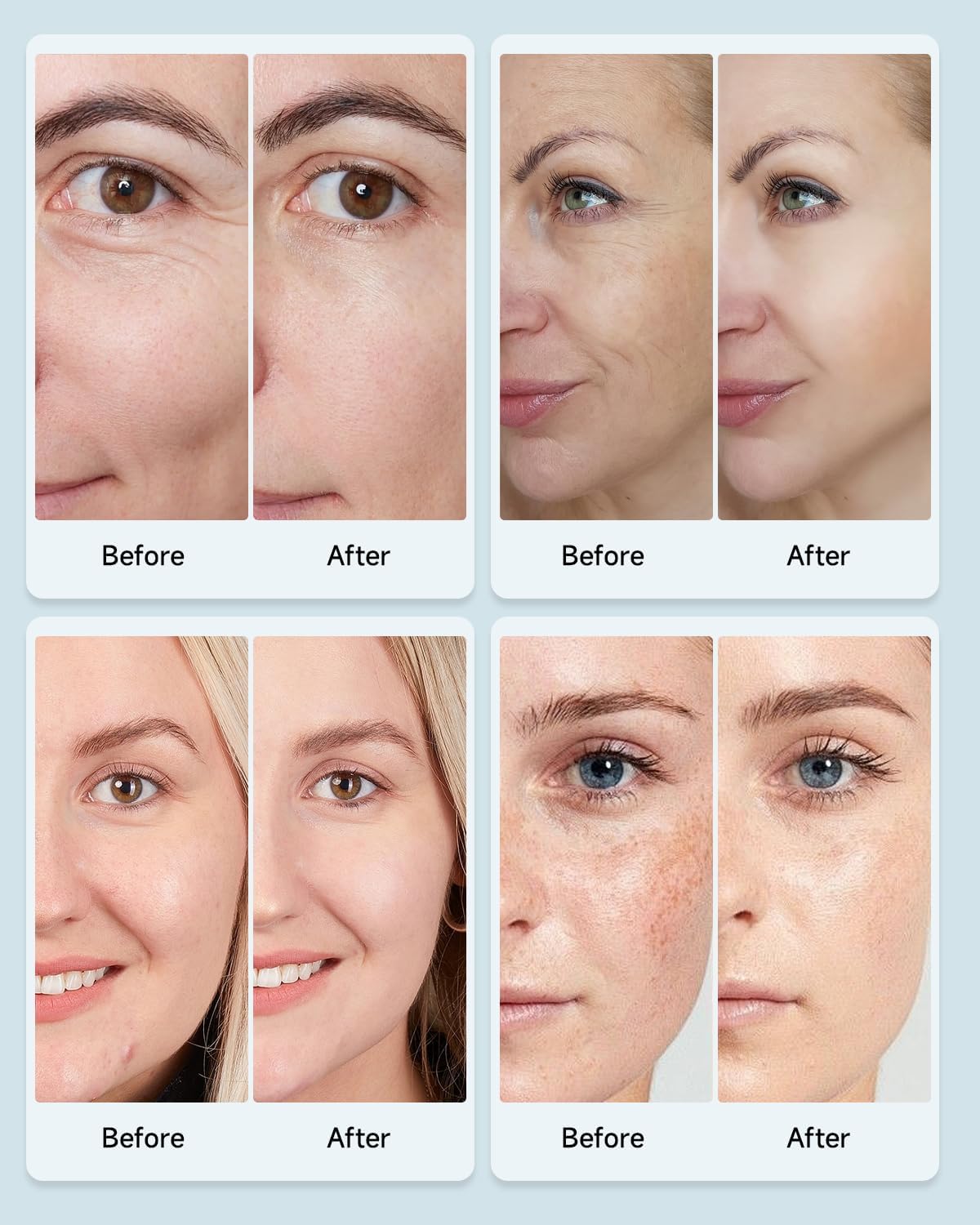 MOLAMOYA LED Light Therapy Mask Skin Rejuvenation
