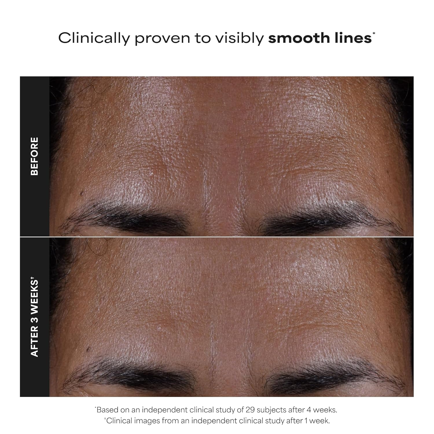 Paula’s Choice 2% BHA Liquid Exfoliant – Salicylic Acid Pore Treatment