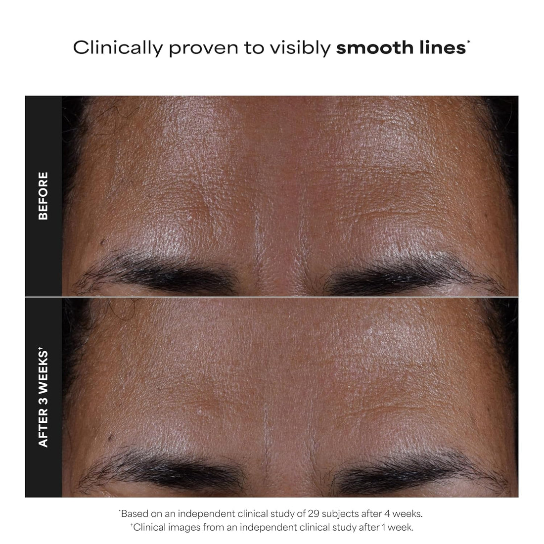 Paula’s Choice 2% BHA Liquid Exfoliant – Salicylic Acid Pore Treatment