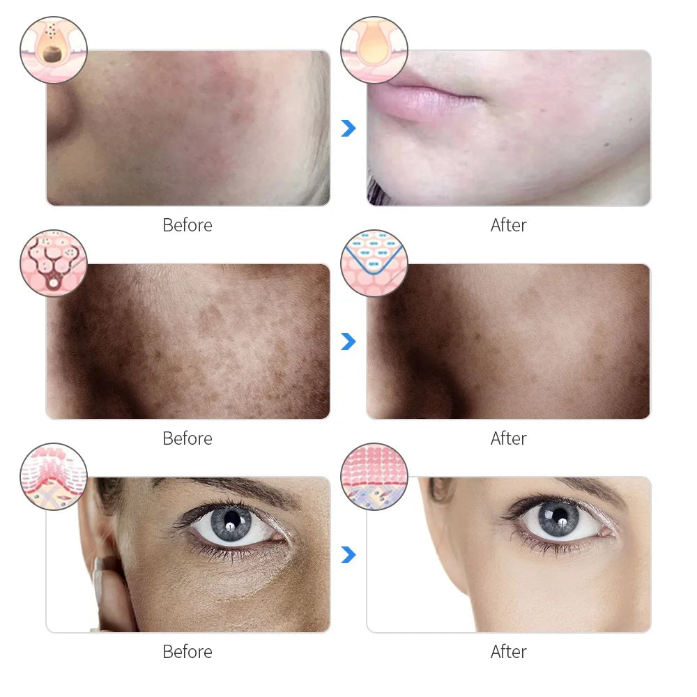 Rechargeable 7-Color LED Face Mask At-Home Light Therapy charging base and accessories