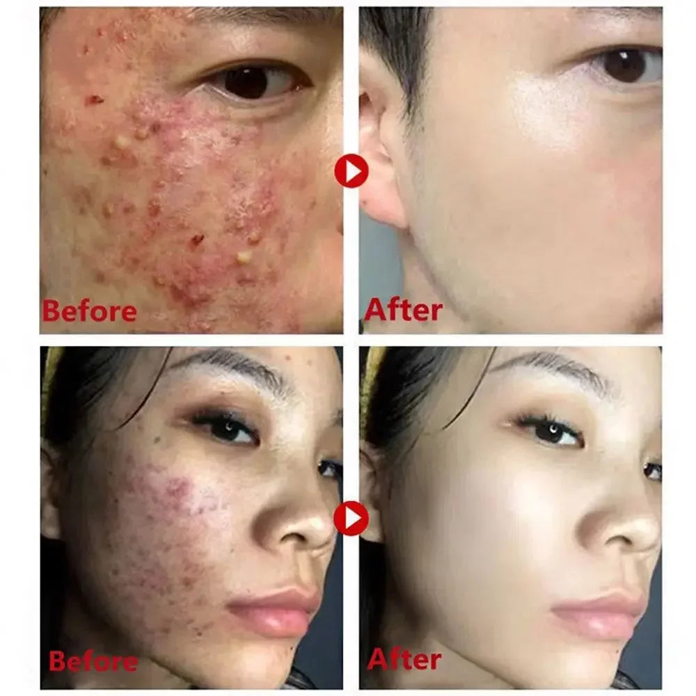 Green Tea Clay Mask Stick Deep Cleansing Oil Control the mask applied on the face
