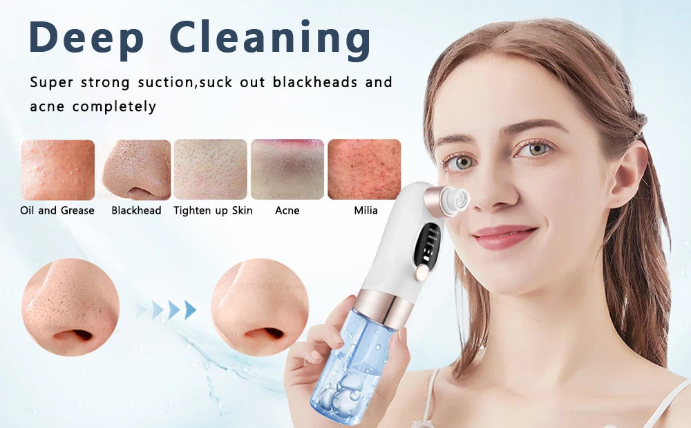 Electric Blackhead Remover Pore Vacuum Cleaner Device