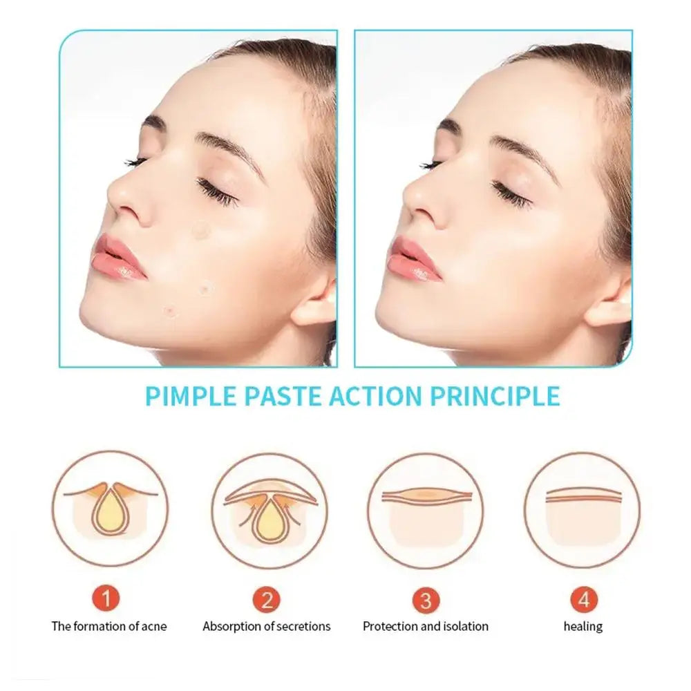 Salicylic Acid Acne Patch Tea Tree Oil Spot Treatment