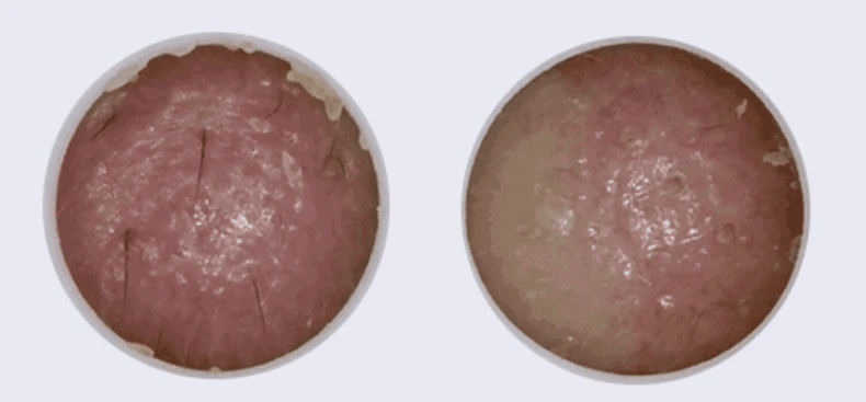 Vitamin C Hyaluronic Acid Glow Brightening Serum