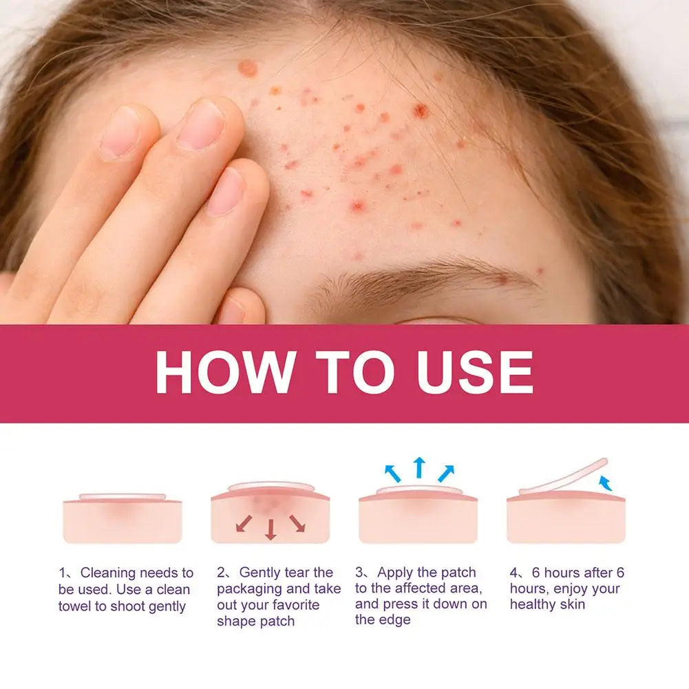 Star Acne Pimple Patches Colorful Invisible Spot Cover additional product view 16
