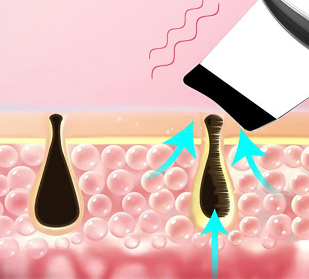 Ultrasonic Skin Scrubber Deep Cleansing Device Tool