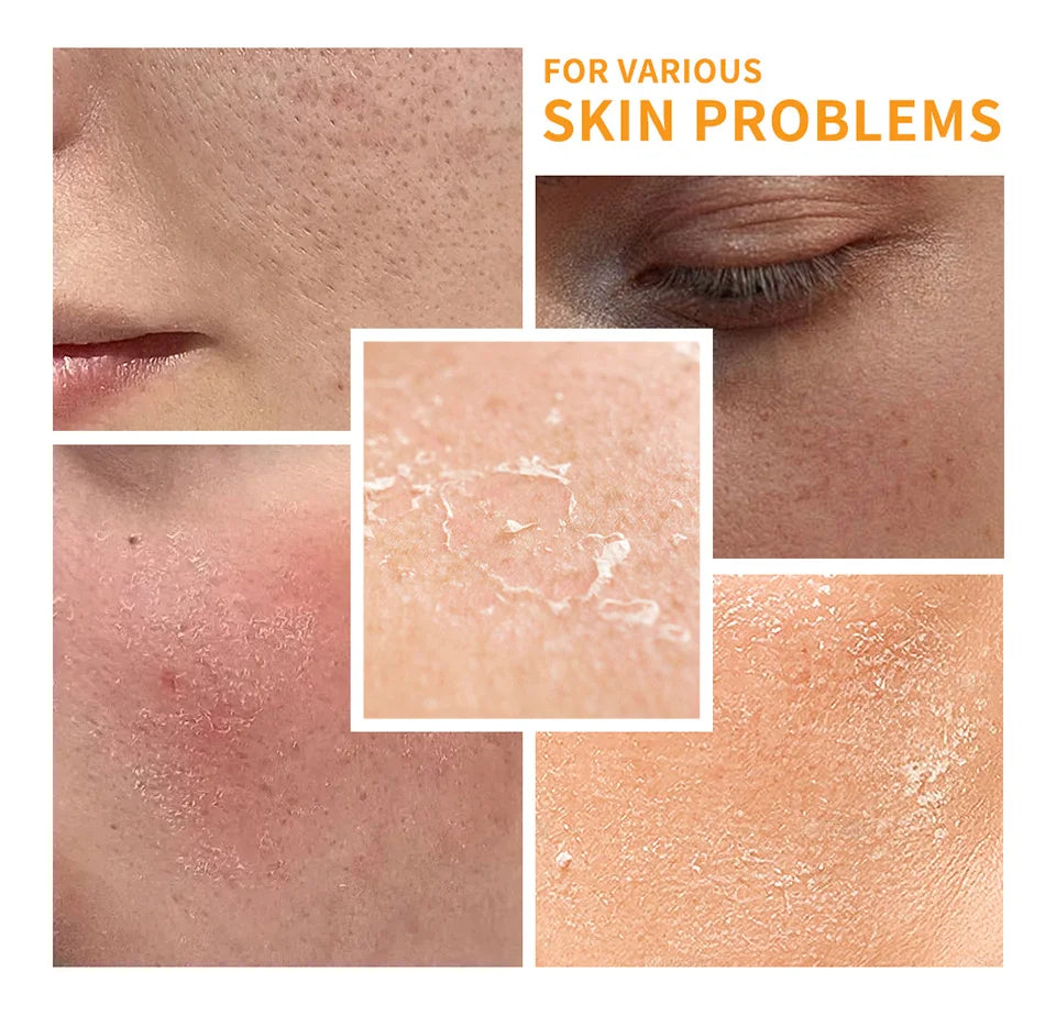 Lakerain Vitamin C Skincare Set additional product view 12