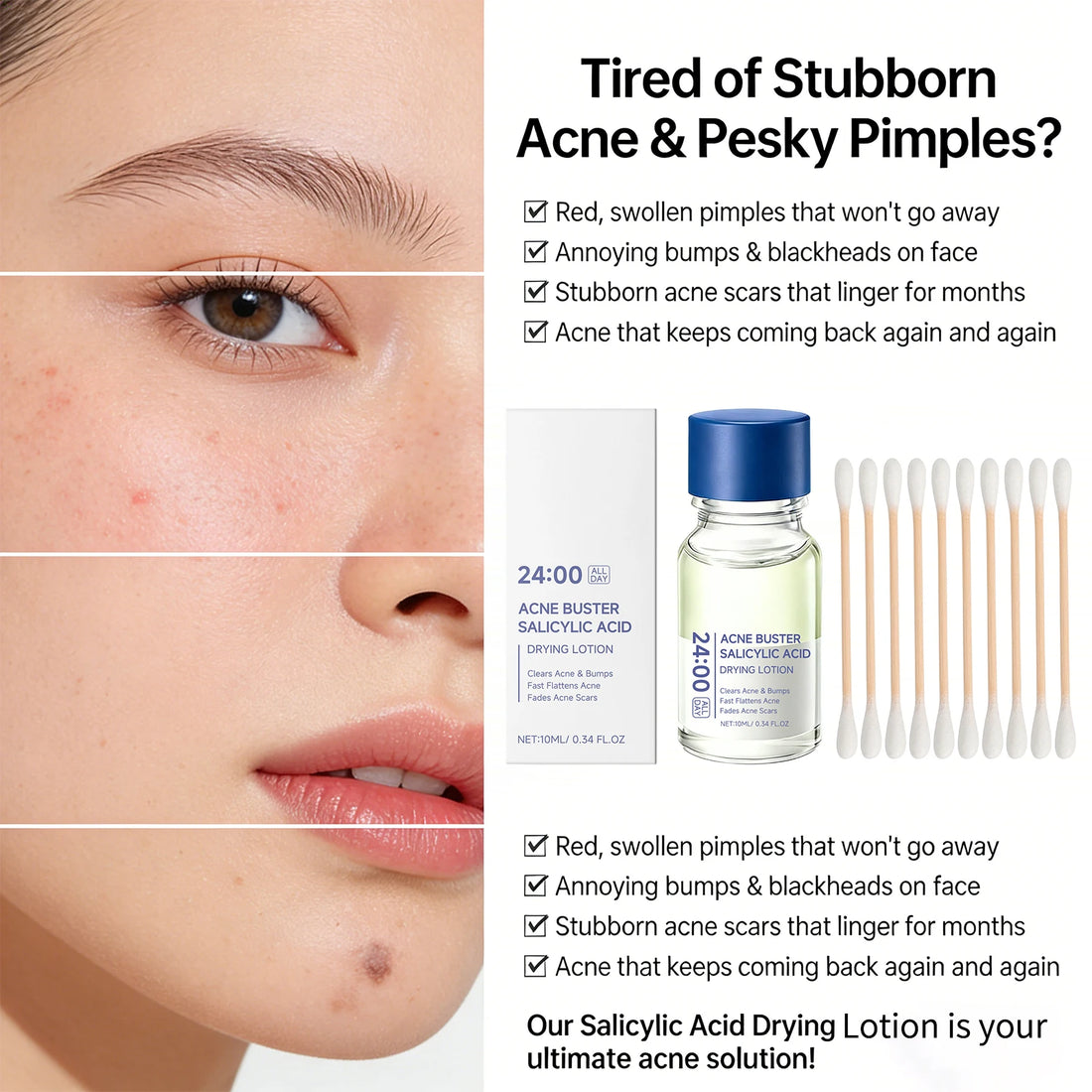 Salicylic Acid Drying Lotion Face Serum with Cotton Swab