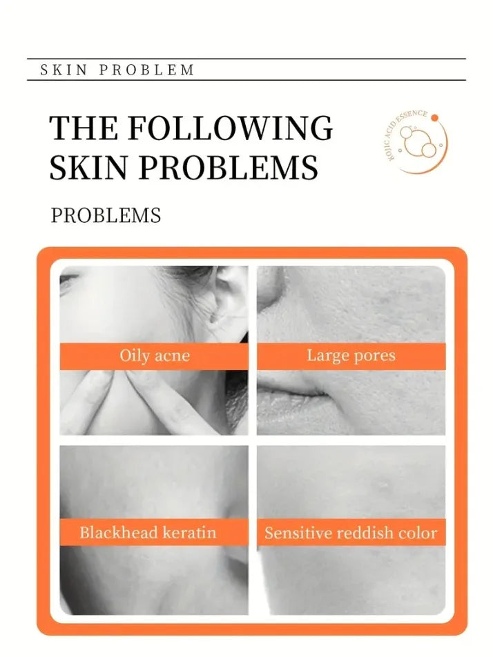 100g Kojic Acid Soap with Vitamin C,Turmeric, Retinol, Shea Butter, Vitamin E, Kojic Acid