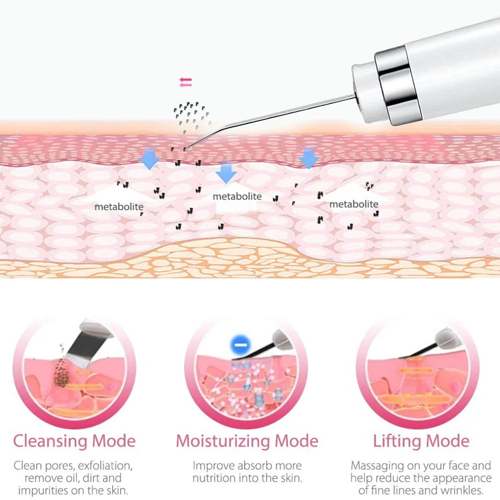 Ultrasonic Skin Scrubber Deep Cleansing Device Tool