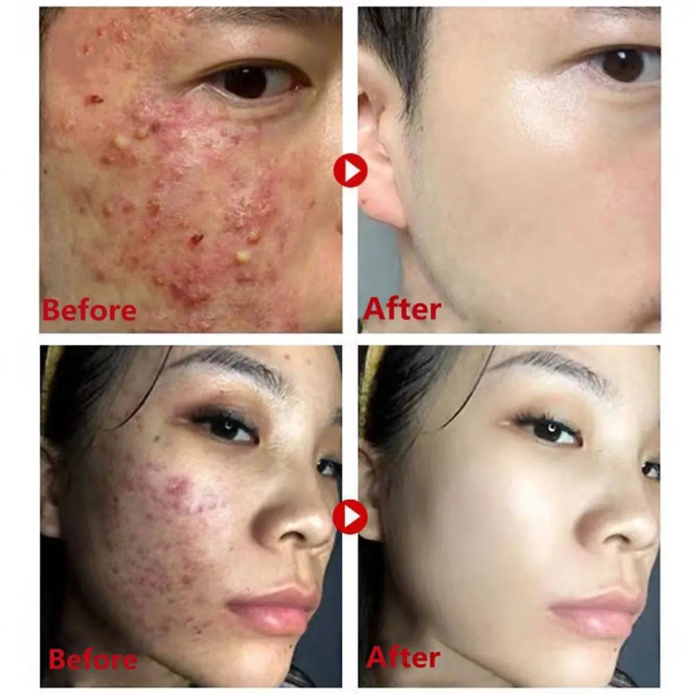 Green Tea Clay Mask Stick Deep Cleansing Oil Control additional product view 12
