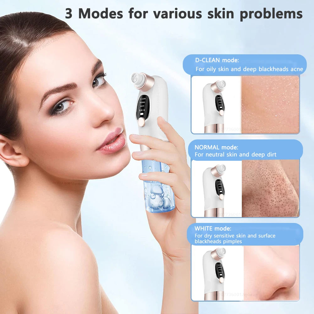 Electric Blackhead Remover Pore Vacuum Cleaner Device