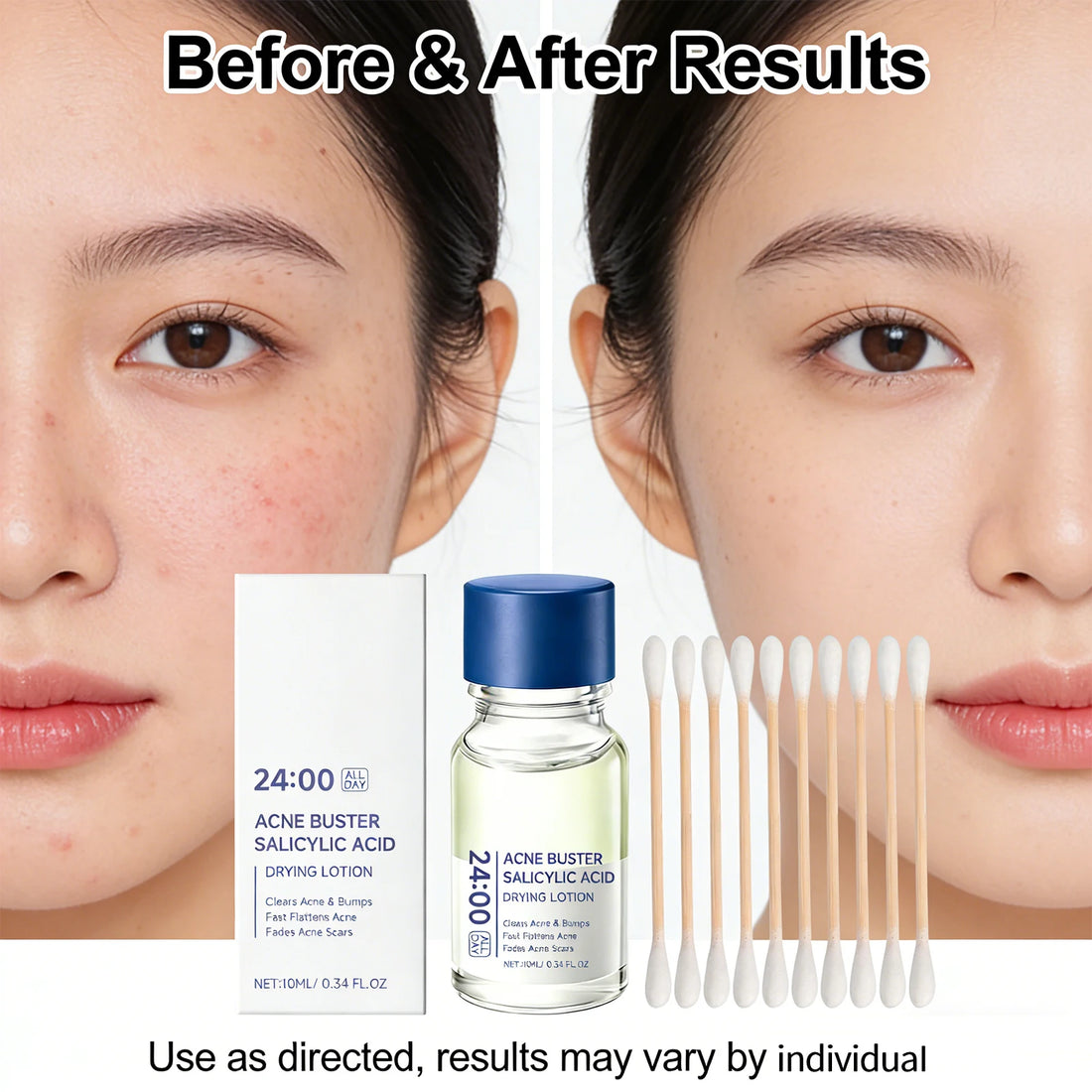 Salicylic Acid Drying Lotion Face Serum with Cotton Swab