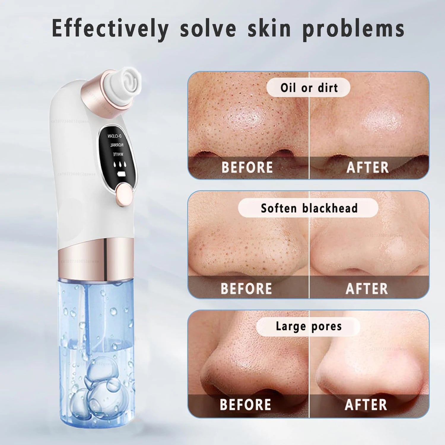 Electric Blackhead Remover Pore Vacuum Cleaner Device