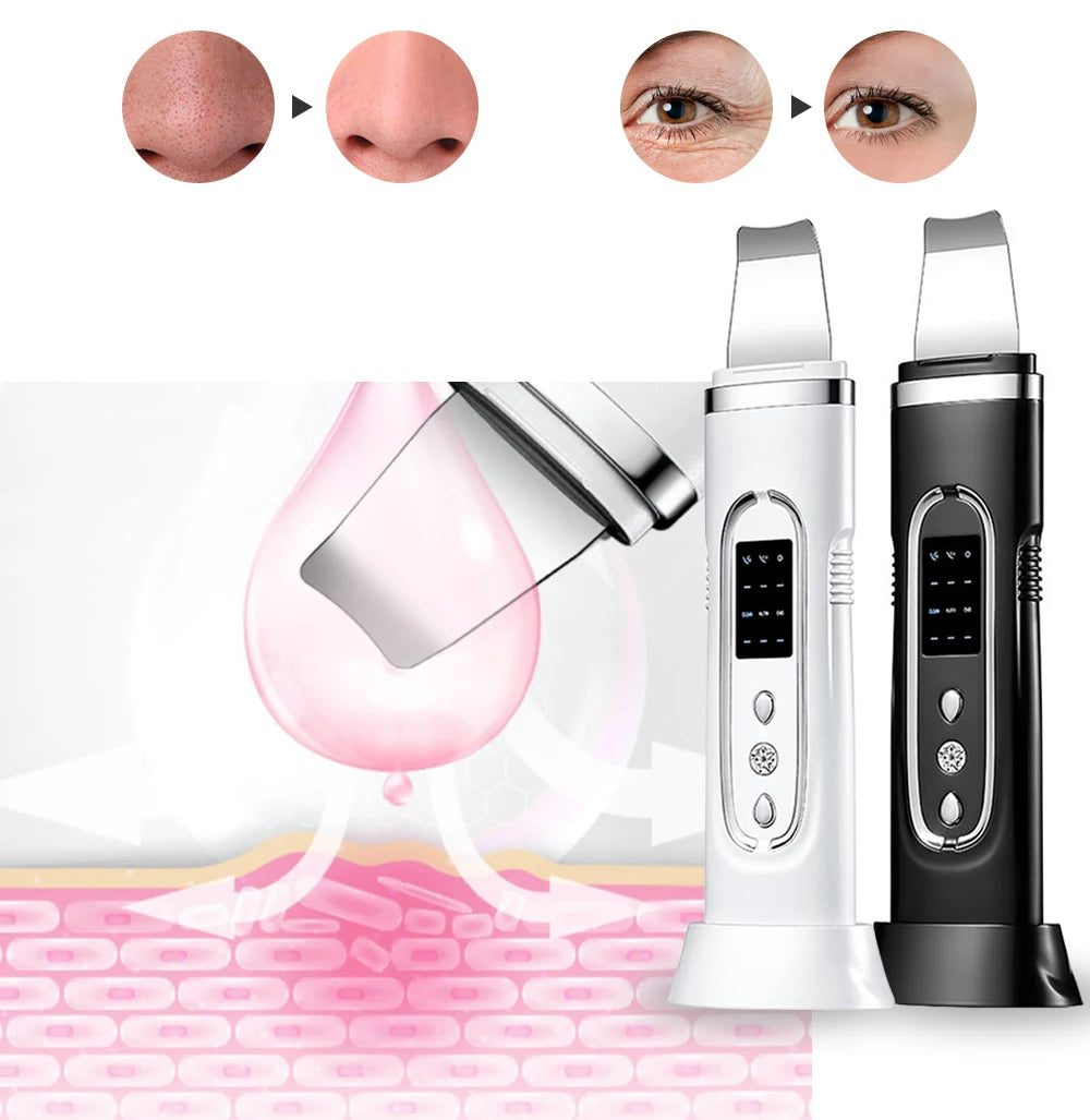 Ultrasonic Skin Scrubber Deep Cleansing Device Tool