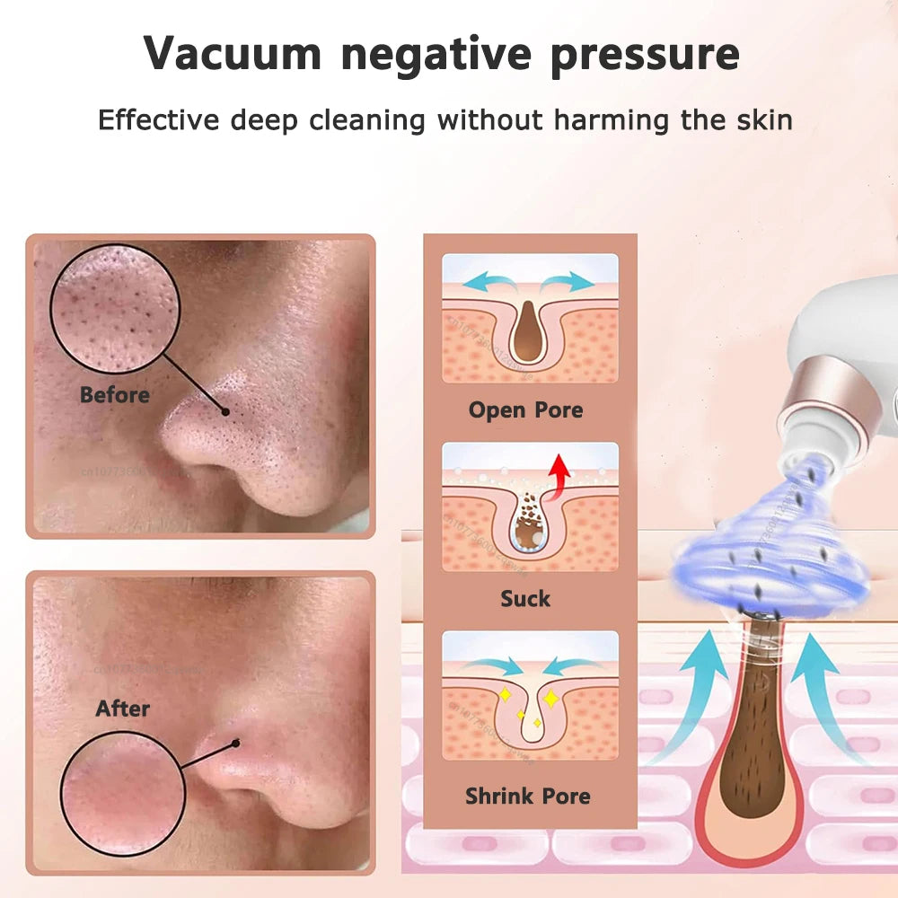 Electric Blackhead Remover Pore Vacuum Cleaner Device