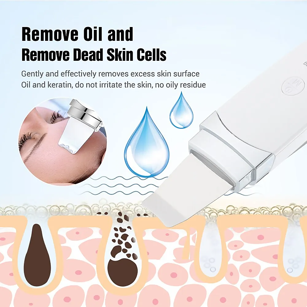 Kalicy 3-in-1 Ultrasonic Skin Care Device Cleanse & Lift additional product view 11