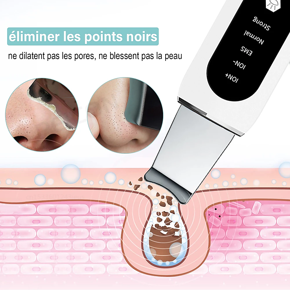 Stellar 5-in-1 Ultrasonic EMS Facial Device with Photon Therapy additional product view 10